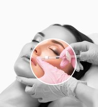 Hyaluron-Unterspritzung der Lippen mit feiner Injektionstechnik