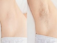 BYONIK Gesichtsbehandlung mit Wirkstoffserum, das sanft auf die Haut aufgetragen wird