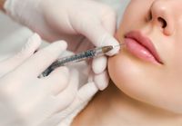 Lippen aufspritzen bei BQ Medical Beauty