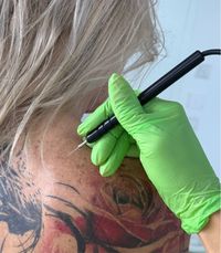 Entfernung von Hautanomalien bei BQ Medical Beauty